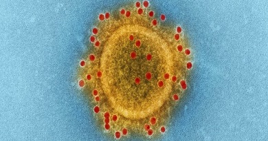 Coronavirus 1