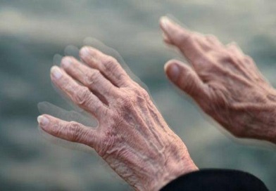 Parkinson, un reto para la salud, la ciencia y la sociedad