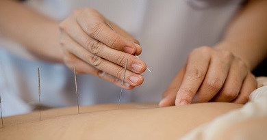 mujer joven tratamiento acupuntura
