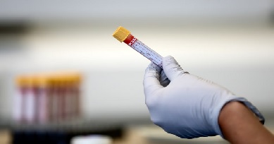 Las proteínas en la sangre podrían advertir a las personas sobre el cáncer más de siete años antes de su diagnóstico