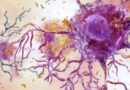 Una variante genética aliada del cerebro contra el Alzheimer