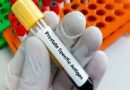 Científicos logran avances en estudios experimentales para frenar el cáncer de próstata